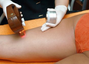 hair removal, beauty, franchise, esthetic, beautician, legs, plucking, hair removal, hair removal, hair removal, hair removal, hair removal