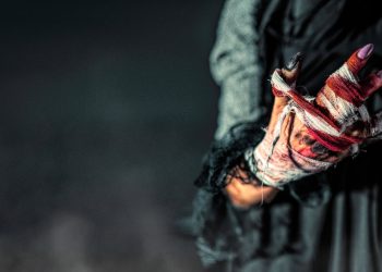 к чему снится отрубленный палец на руке